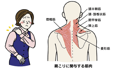 寝違え 背中 【危険？】肩甲骨に寝違えたような痛みが起こる３つの原因と予防策